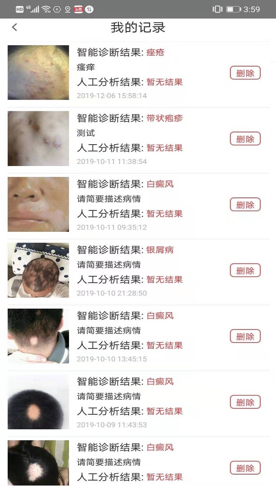 皮肤病诊断选药